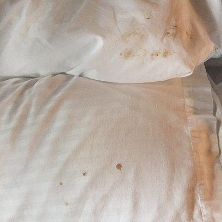 how to clean vomit from pillow